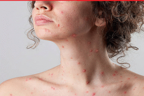 sucicegi-olan-kadin-emzirebilir-mi-k430