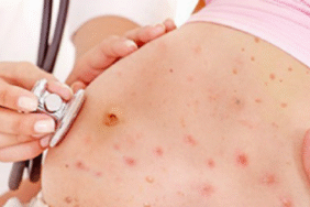 hamileyken-sucicegi-asisi-yaptirilir-mi-k34