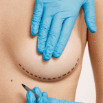 meme-buyutme-ameliyatindan-kac-ay-sonra-hamile-kalinabilir-k349