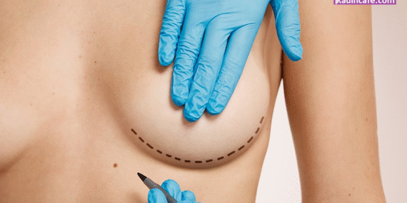 meme-buyutme-ameliyatindan-kac-ay-sonra-hamile-kalinabilir-k349