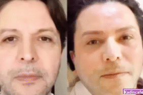 nihat-dogan-estetik-oldu-sosyal-medya-yikildi-k32933