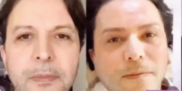 nihat-dogan-estetik-oldu-sosyal-medya-yikildi-k32933